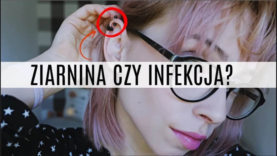 Jak leczyć infekcję po piercingu: skuteczne metody i porady